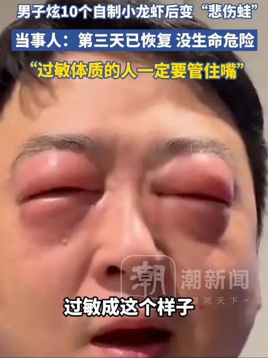 男子炫10个自制小龙虾后过敏,当事人:第三天已恢复,没有生命危险