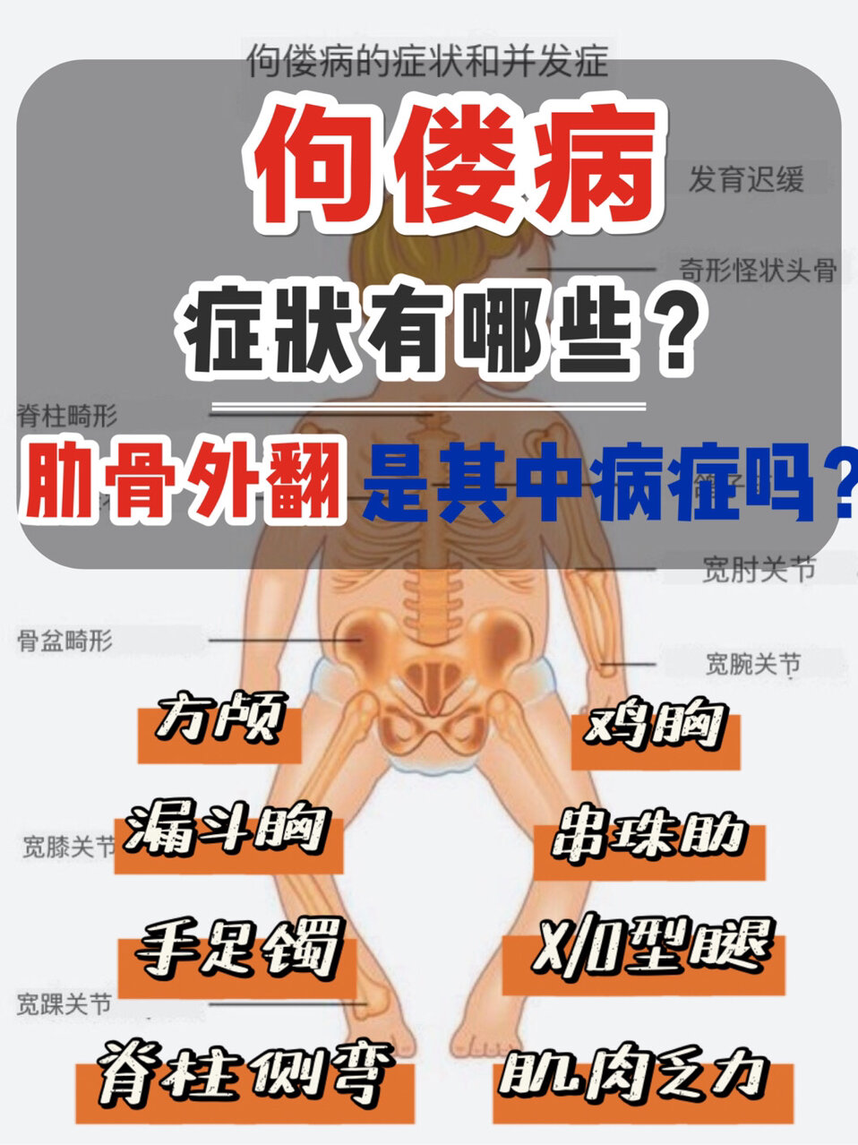 佝偻病的症状有哪些?怎么治疗?