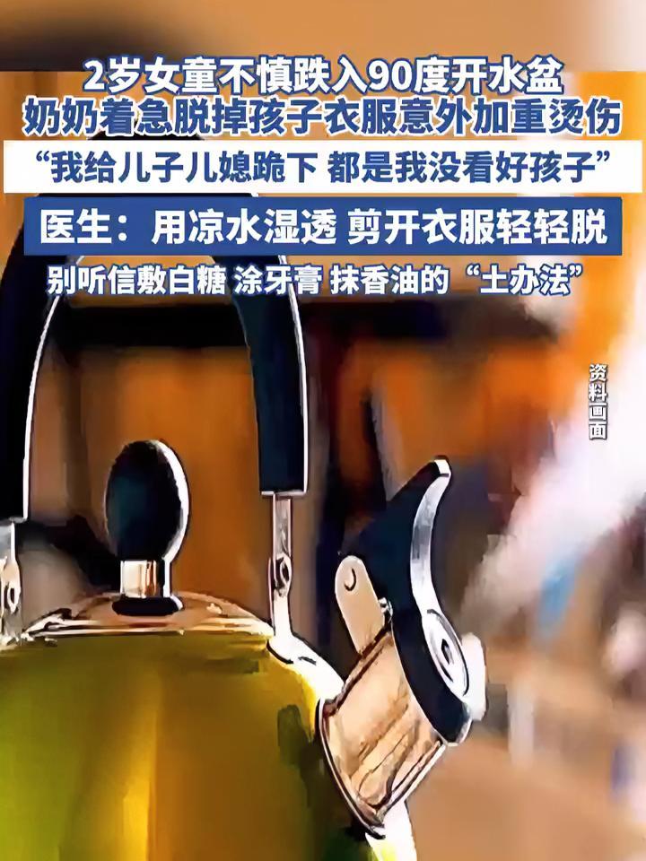 2岁女童跌入开水盆老人着急脱衣烧伤加重(河南广电)烫伤 看孩子 安全