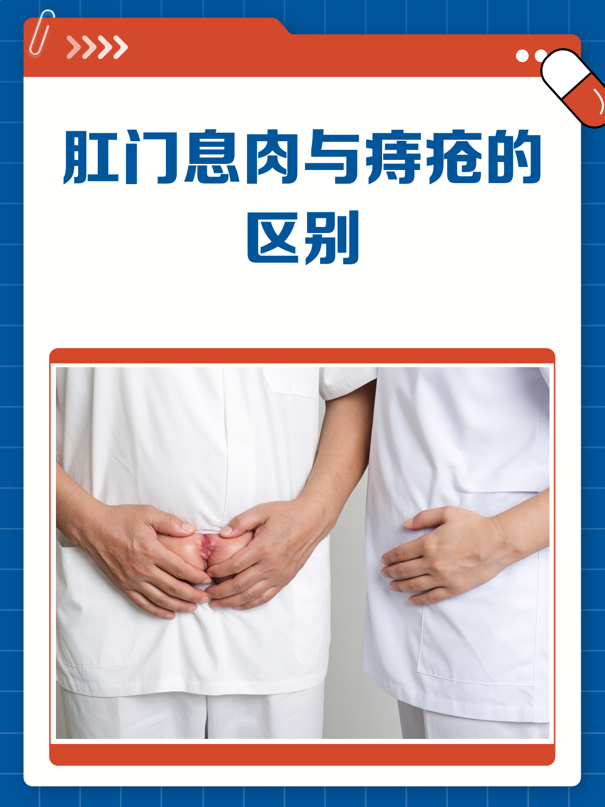 肛门息肉VS痔疮，别再傻傻分不清！