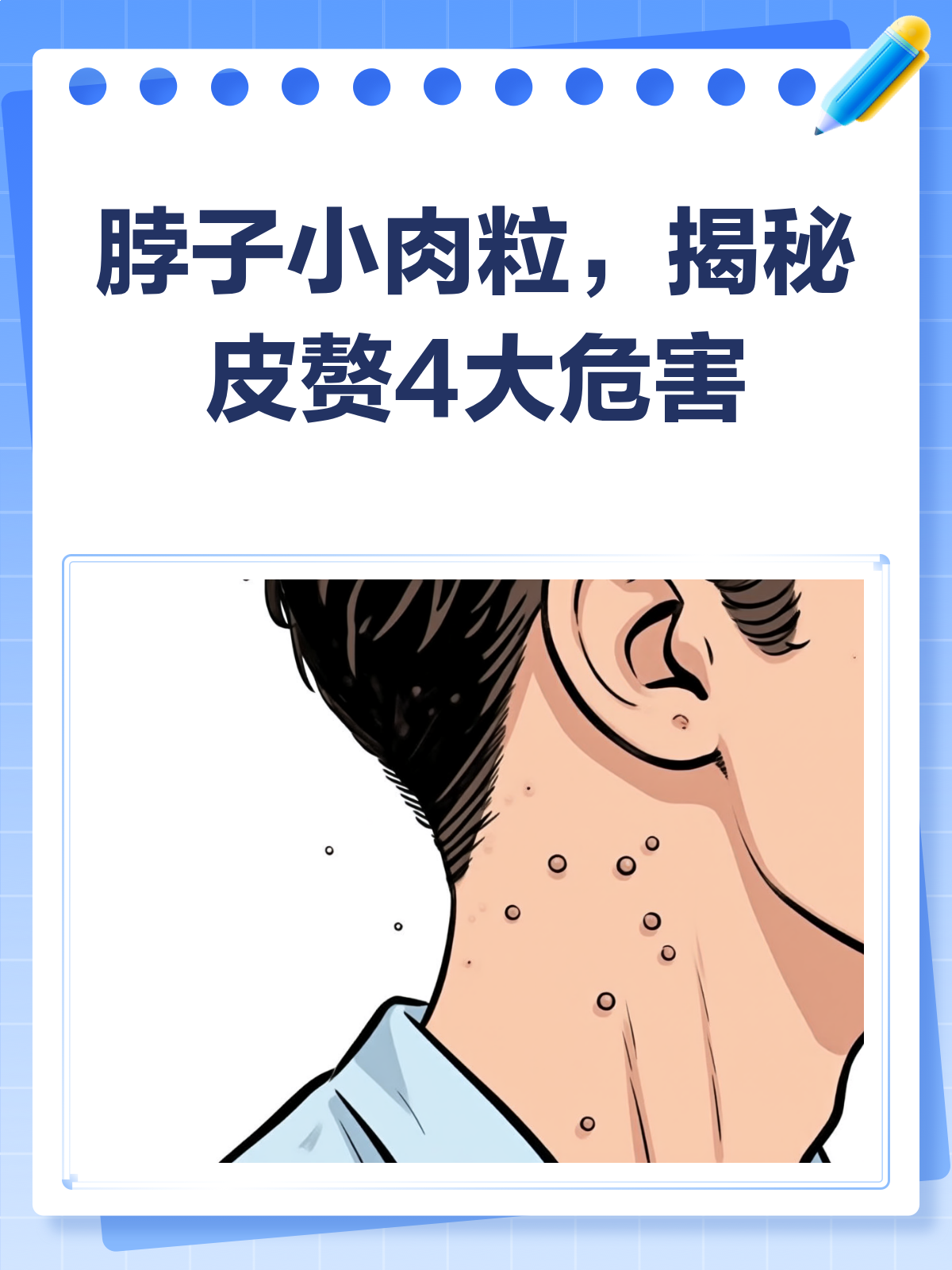 脖子长小肉粒别忽视!可能是皮赘,这些危害你要知道