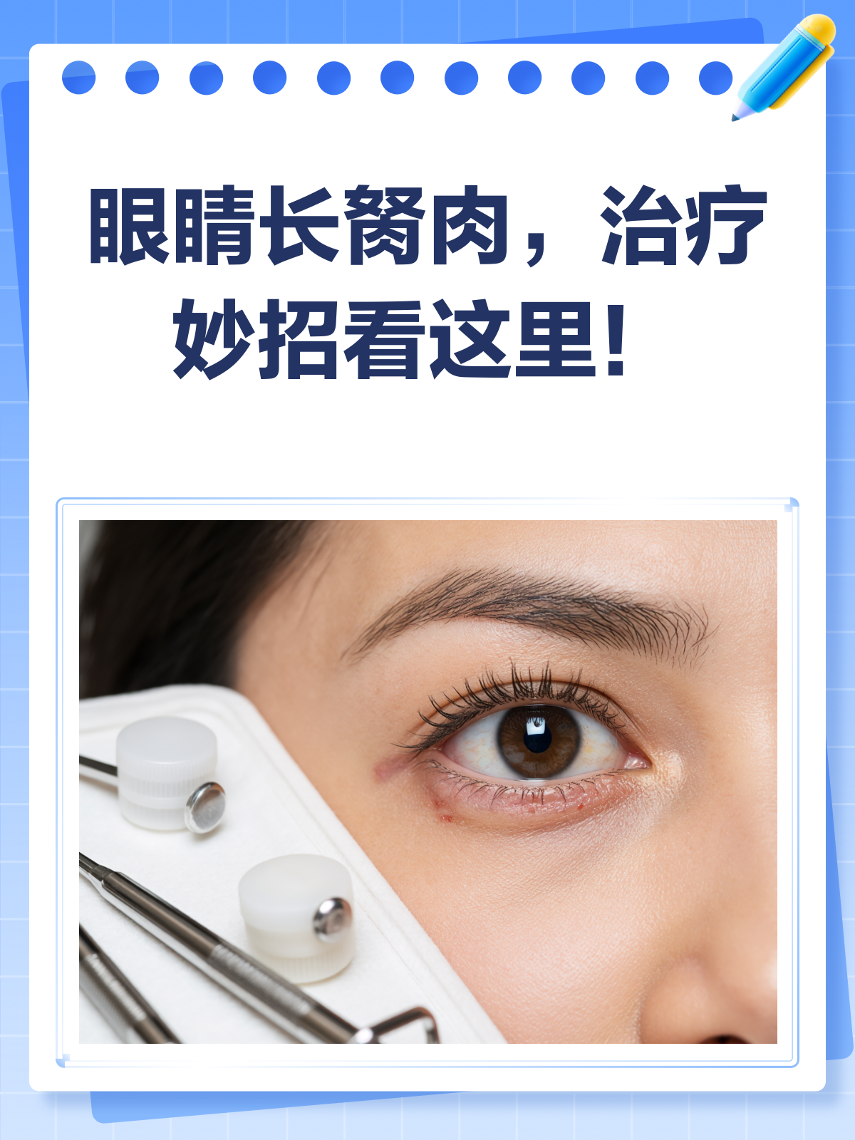 眼睛胬肉怎么办?治疗攻略来啦!