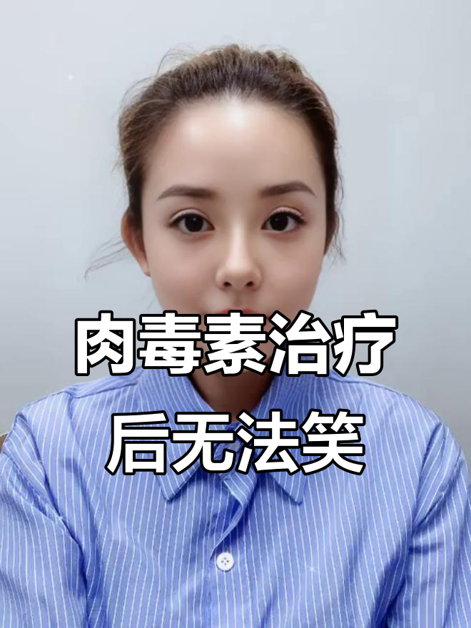 打肉毒素去法令纹,结果笑不出来?恢复期太痛苦了!