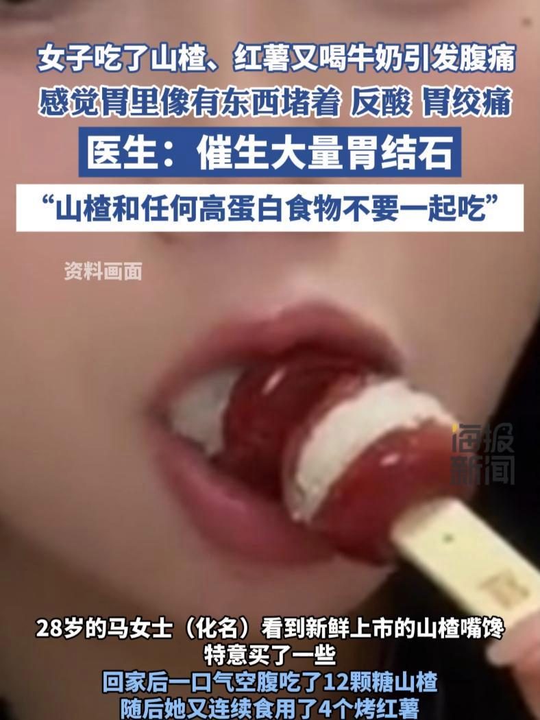 女子吃了山楂、红薯又喝牛奶引发腹痛,医生:催生大量胃结石 “山楂和任何高蛋白食物不要一起吃