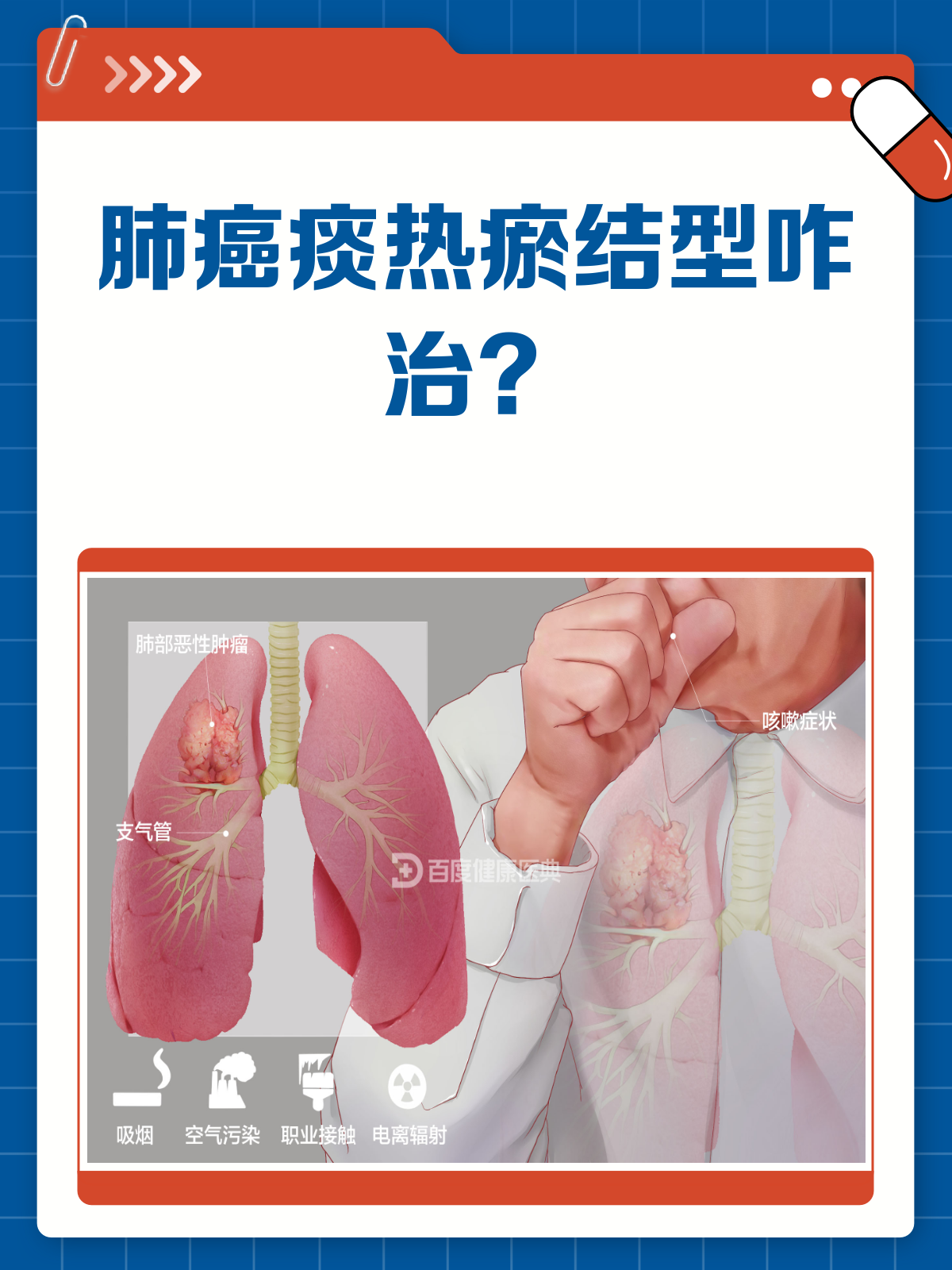 肺癌痰热瘀结型怎么办?清金化痰汤来帮忙!