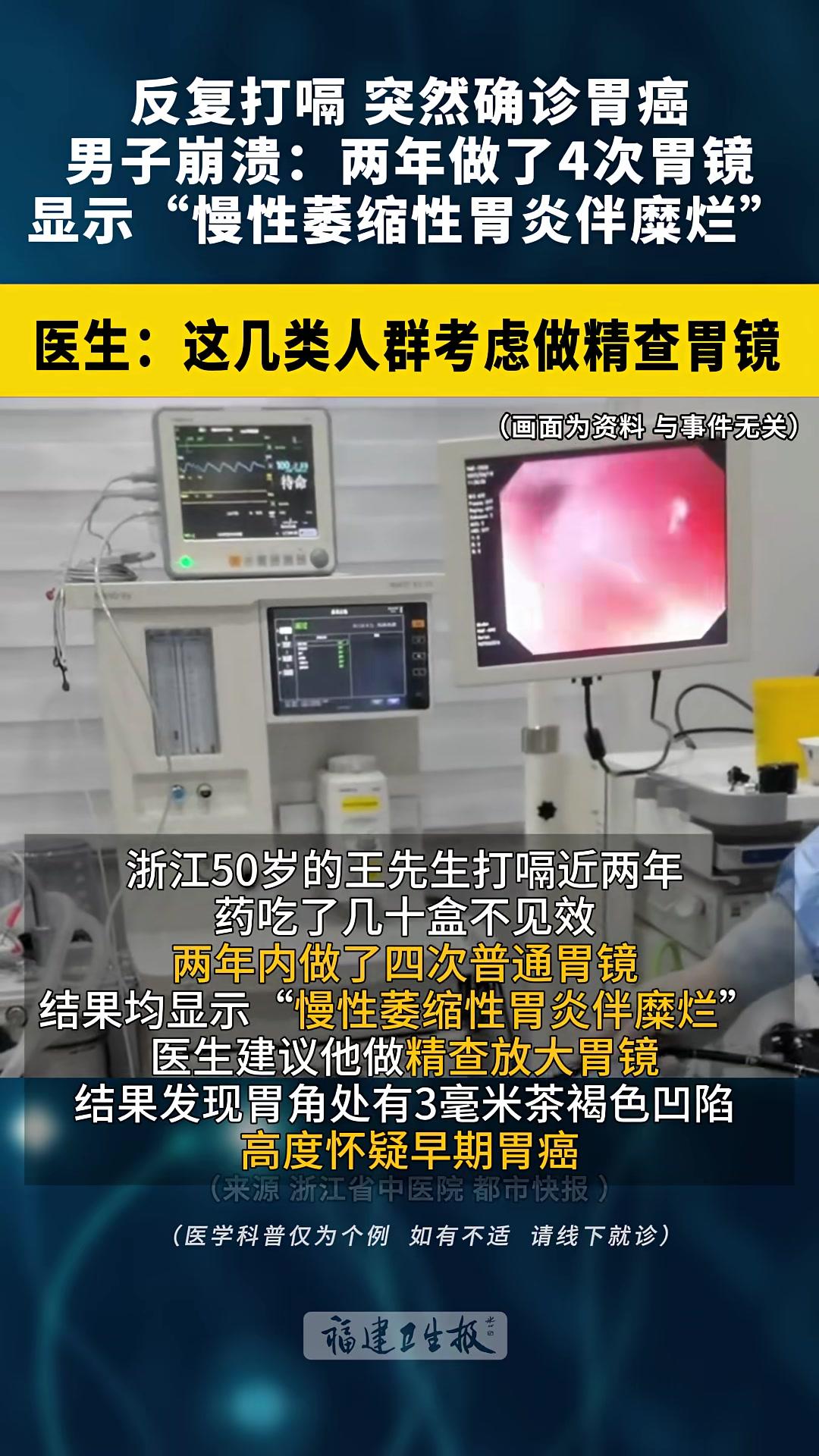 反复 打嗝突然确诊 胃癌!浙江男子崩溃:两年做了4次 胃镜,均显示“慢性 萎缩性胃炎伴 糜