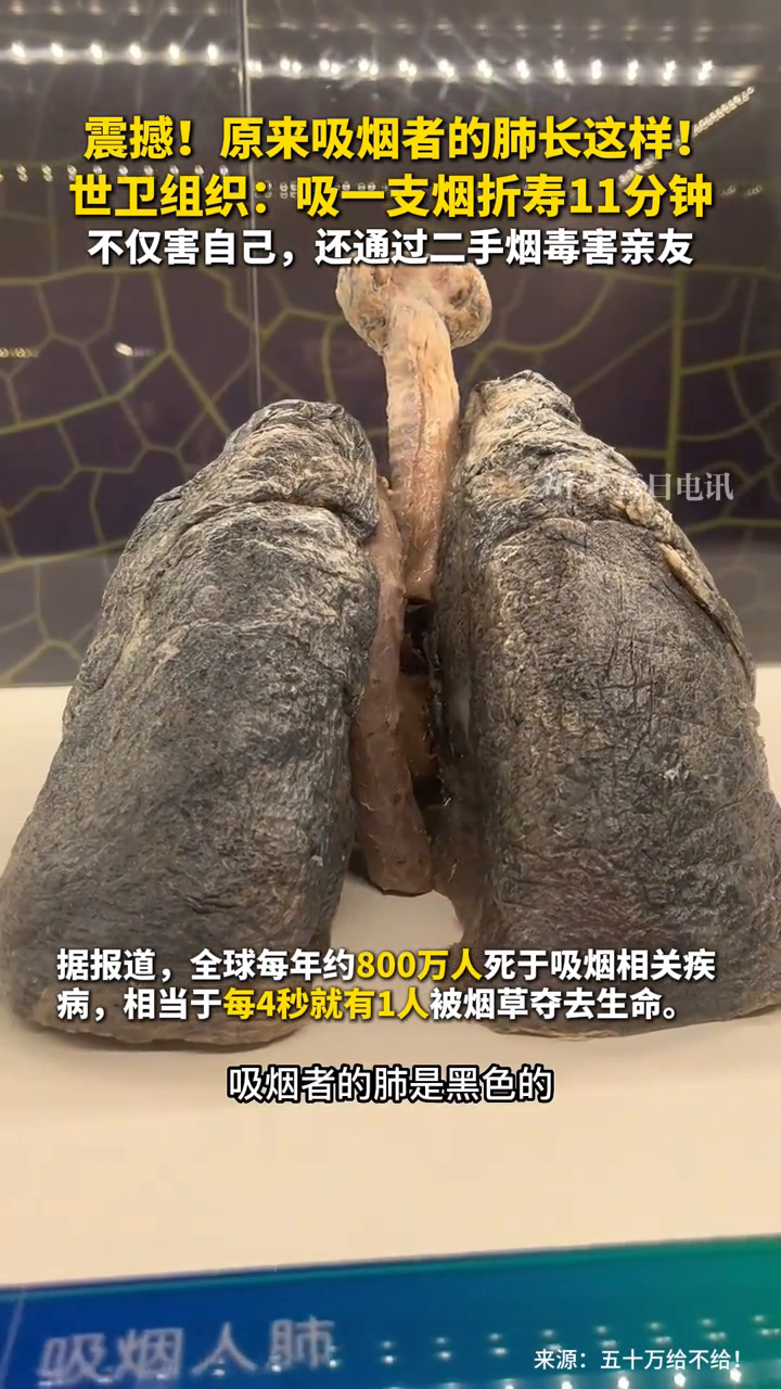 震撼!原来吸烟者的肺长这样!