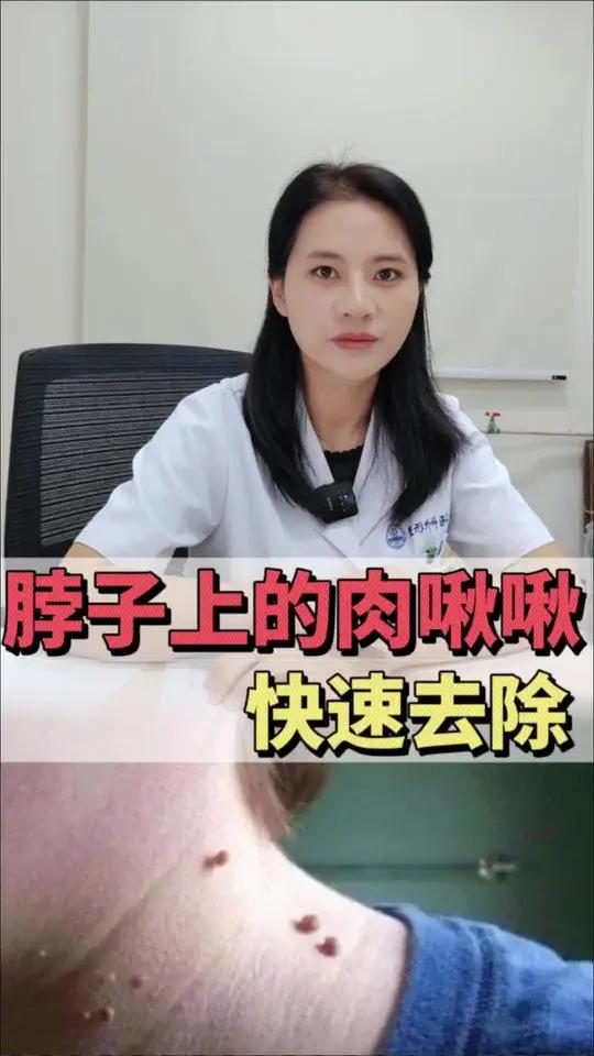 脖子上的小肉揪揪如何快速去除