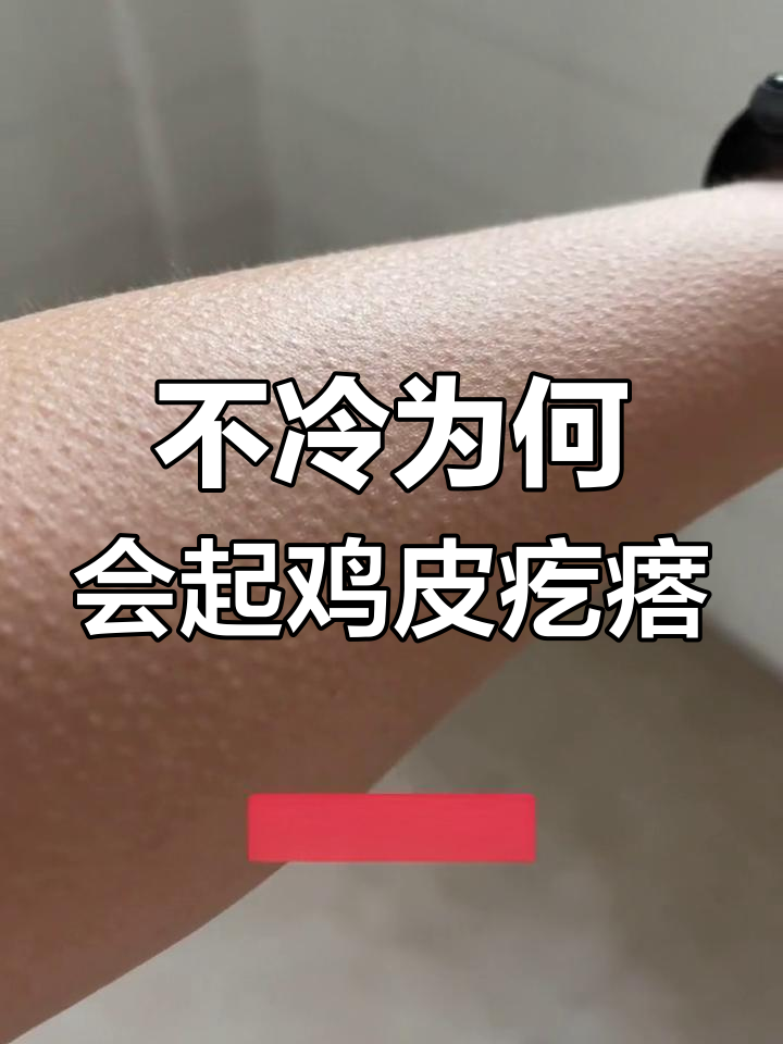身上突然起鸡皮疙瘩,原因是什么?