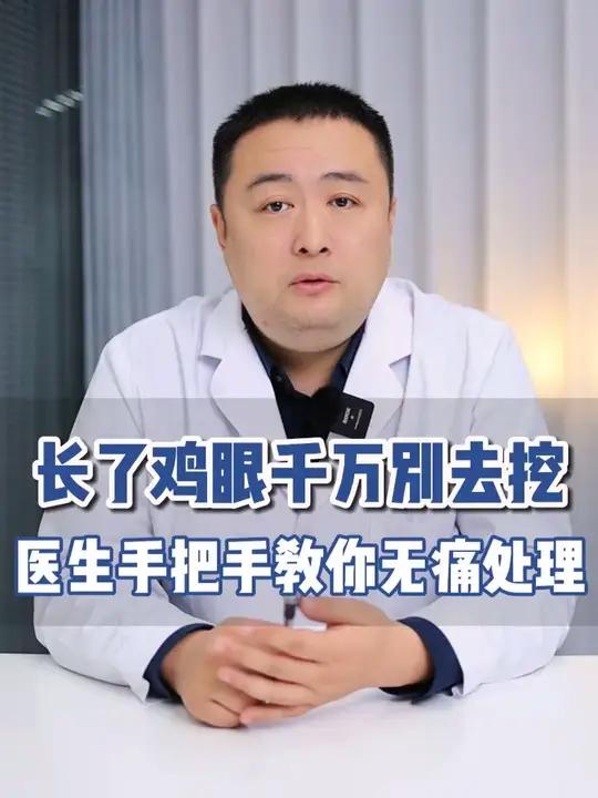 长了鸡眼别挖，医生教你无痛处理