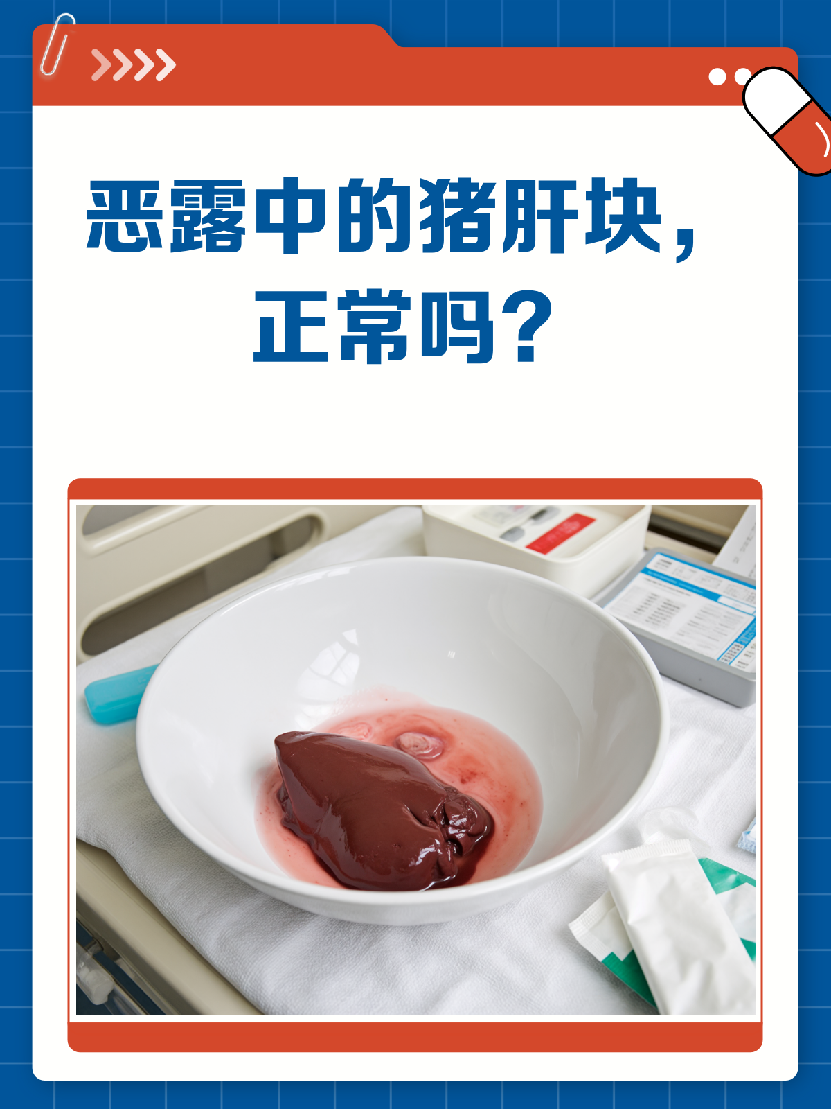 恶露排出像猪肝块?别急,先看看这篇!