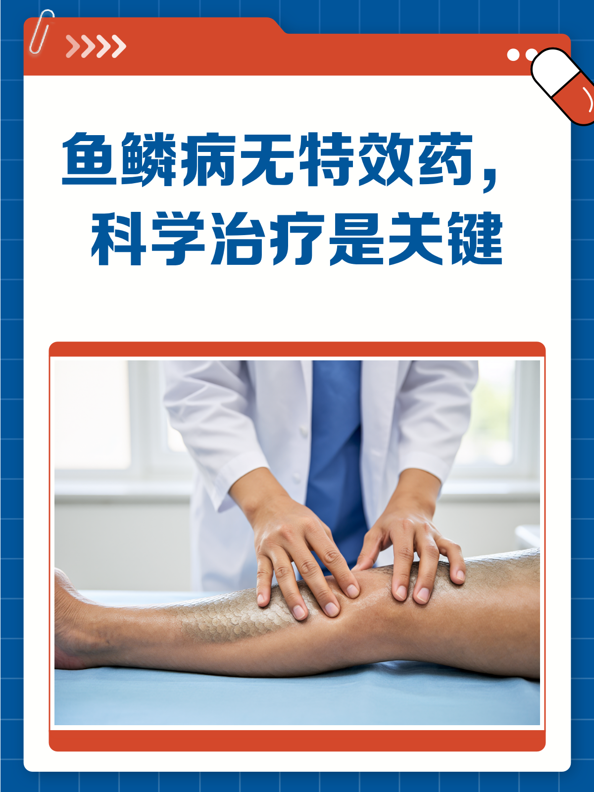 鱼鳞病治疗,别迷信特效药!