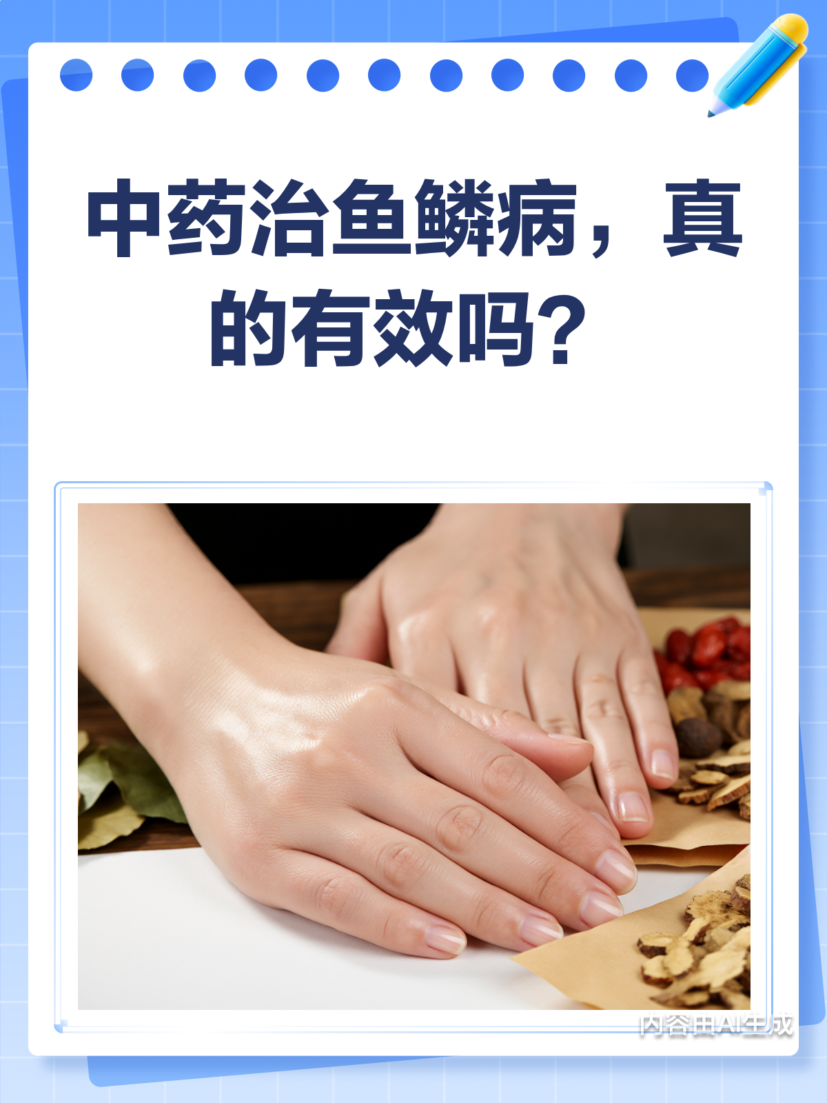 中药能治鱼鳞病吗?看完这篇就懂了!