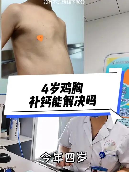 4岁鸡胸,补钙能解决吗