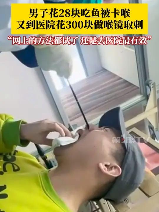 男子花28块吃鱼被卡喉,随后又到医院花300块做喉镜取刺:喝醋、喝可乐、吃馒头……网上消鱼
