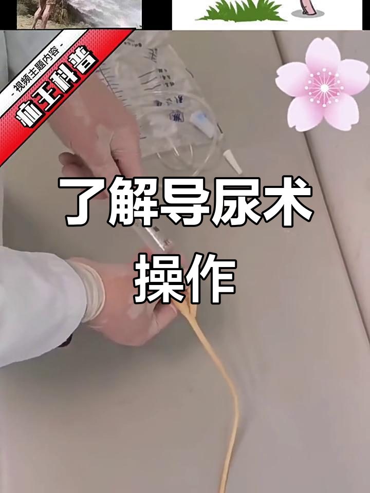导尿术操作详解:如何正确插入导尿管并固定