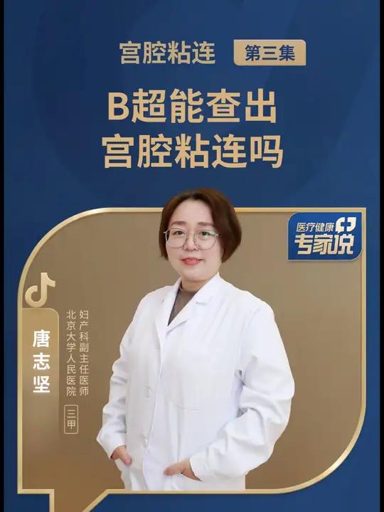 B超能查出宫腔粘连吗?