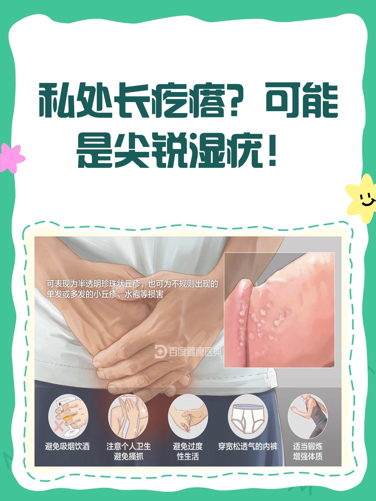 私处长疙瘩?别慌,先来看看这可能是什么