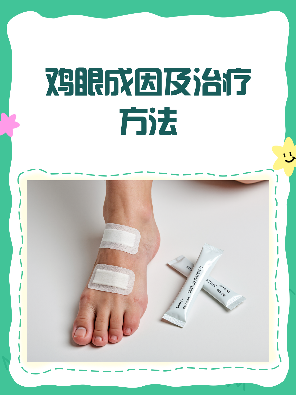 鸡眼烦恼?一文告诉你原因与治疗方法