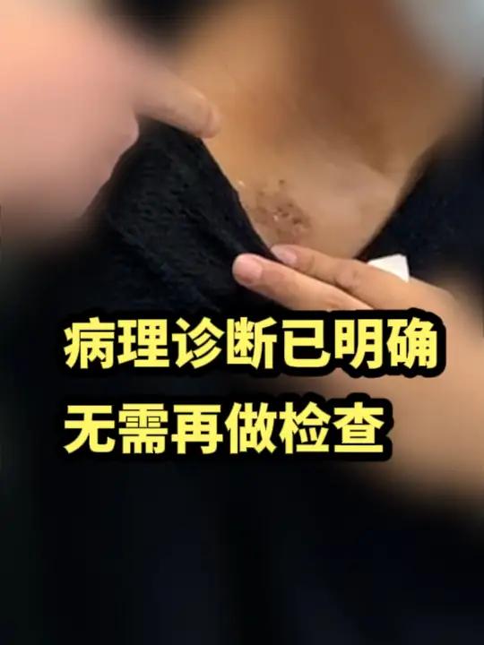 病理诊断已经明确,就不需要再花钱做进一步检查骨肿瘤 滑膜肉瘤