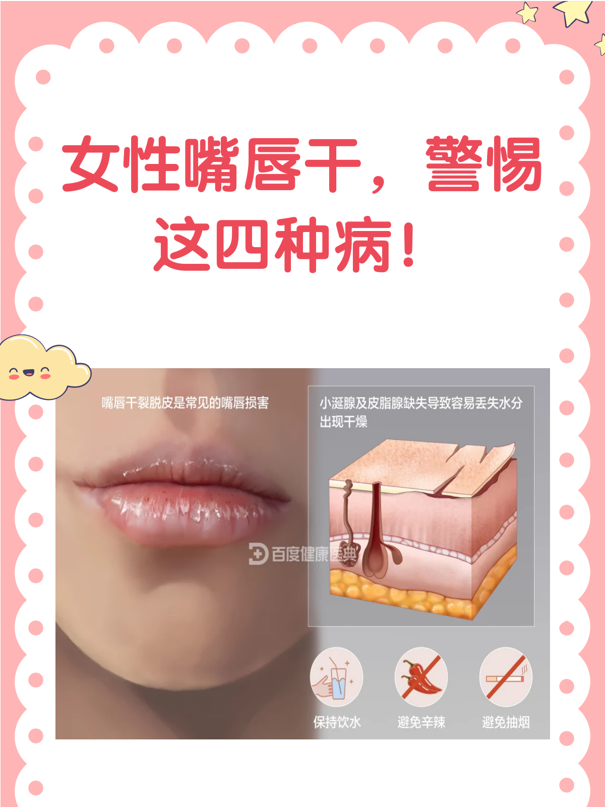 女人嘴唇干要警惕四种病!
