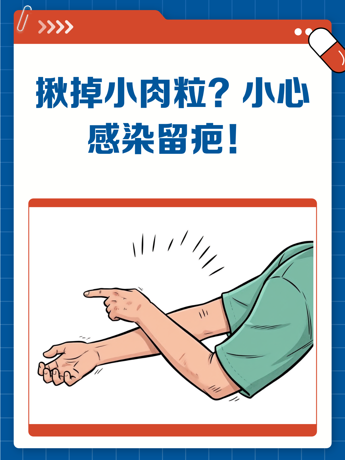 脖子腋下小肉粒，别冲动揪掉！