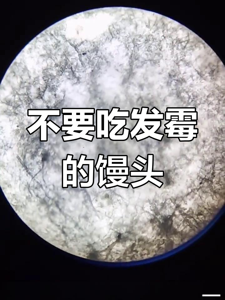 发霉馒头放大500倍,你敢吃吗?