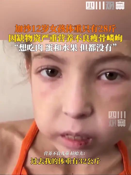 心疼!5月4日据央视新闻,加沙12岁女孩体重仅28斤说想吃肉,曾经她健康可爱,如今瘦骨嶙峋