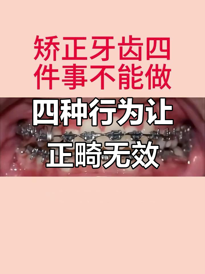 牙齿矫正期间这四个习惯不能有,否则影响效果