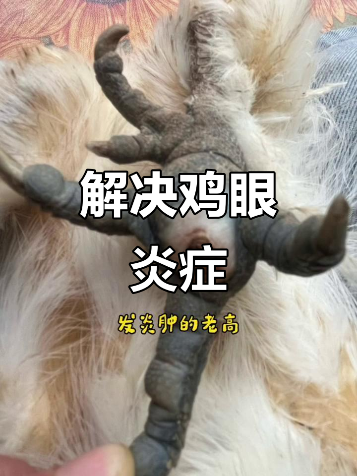 鸡眼发炎怎么办?简单步骤教你轻松解决