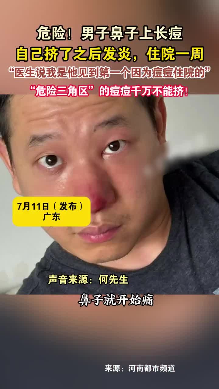 危险!男子鼻子上长痘,自己挤了之后发炎,住院一周