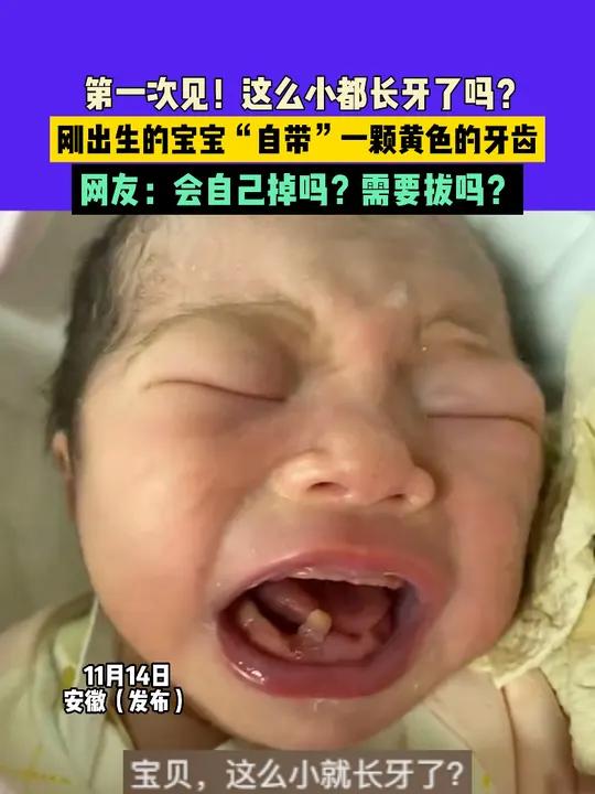 11月14日安徽(发布),第一次见!这么小都长牙了吗?刚出生的宝宝“自带”一颗黄色的牙齿,