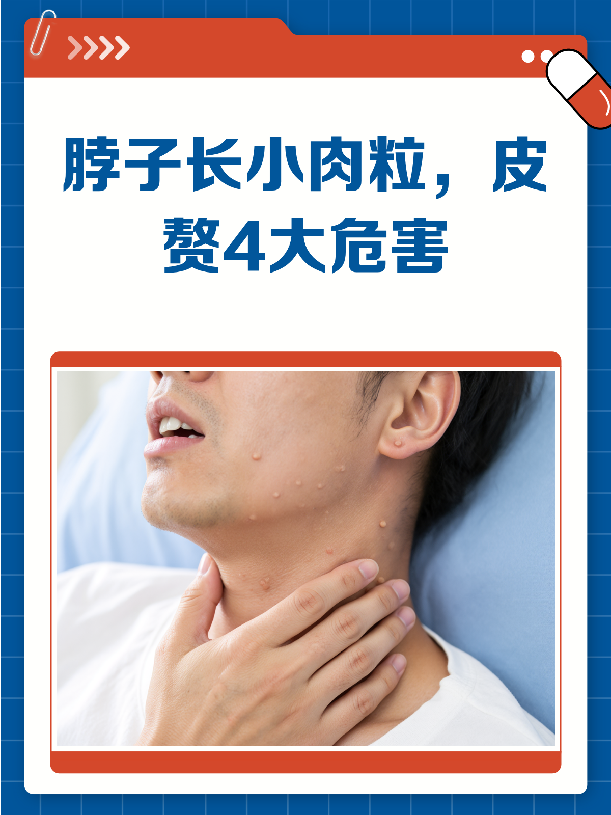 脖子长小肉粒别忽视!可能是皮赘,这些危害你知道吗?
