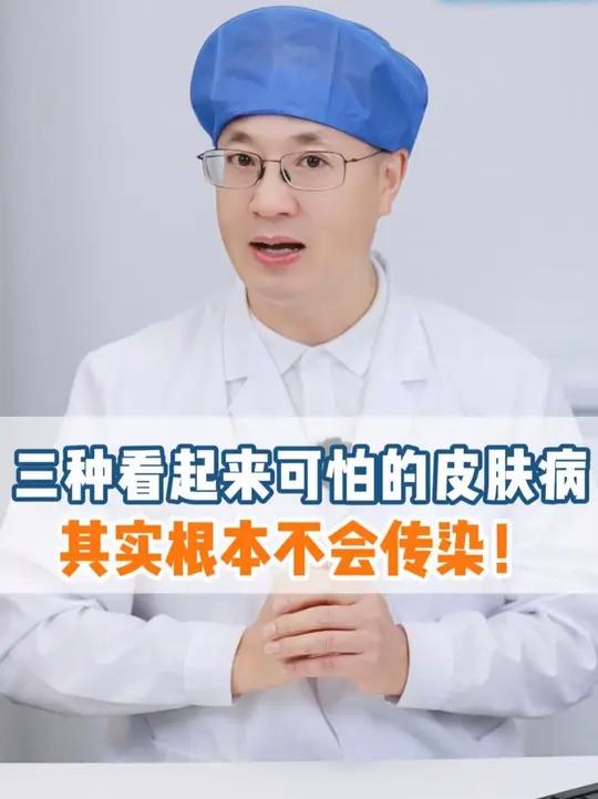 这三种看起来很可怕的皮肤病,其实根本不会传染!医生教你正确分清处理