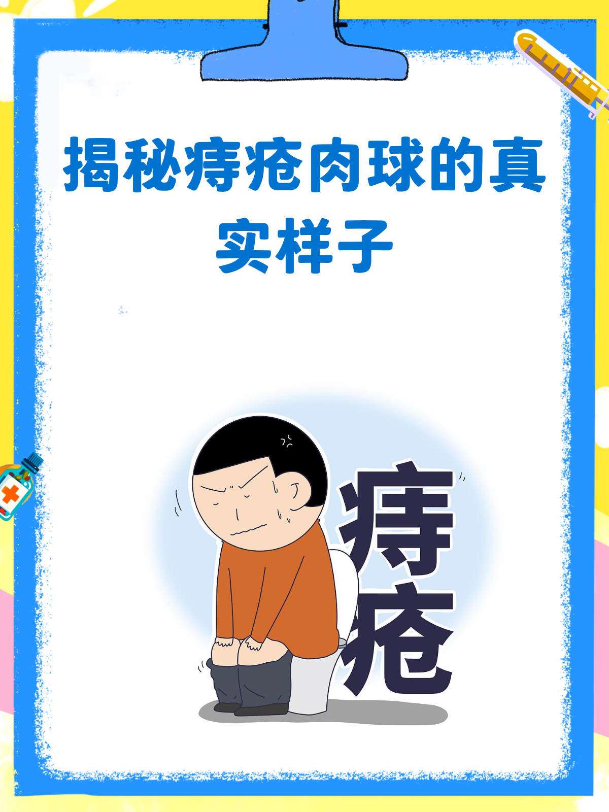 痔疮肉球长啥样?一文看懂内痔外痔混合痔!
