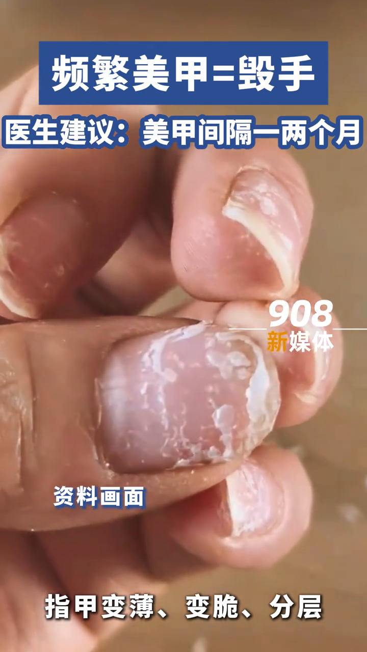 频繁美甲=毁手！医生建议：美甲间隔一两个月