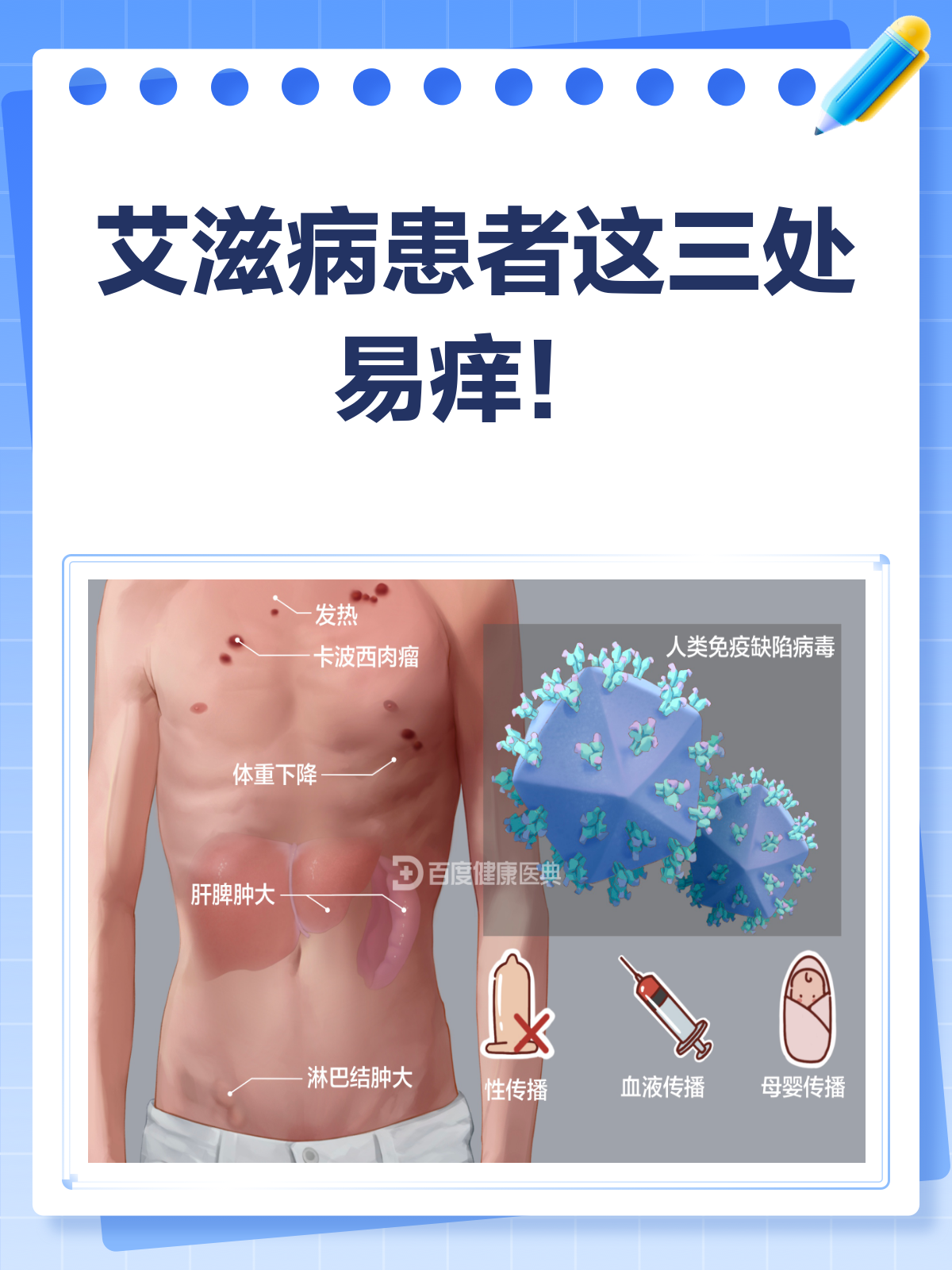 艾滋病一般哪三处会痒?快来了解一下