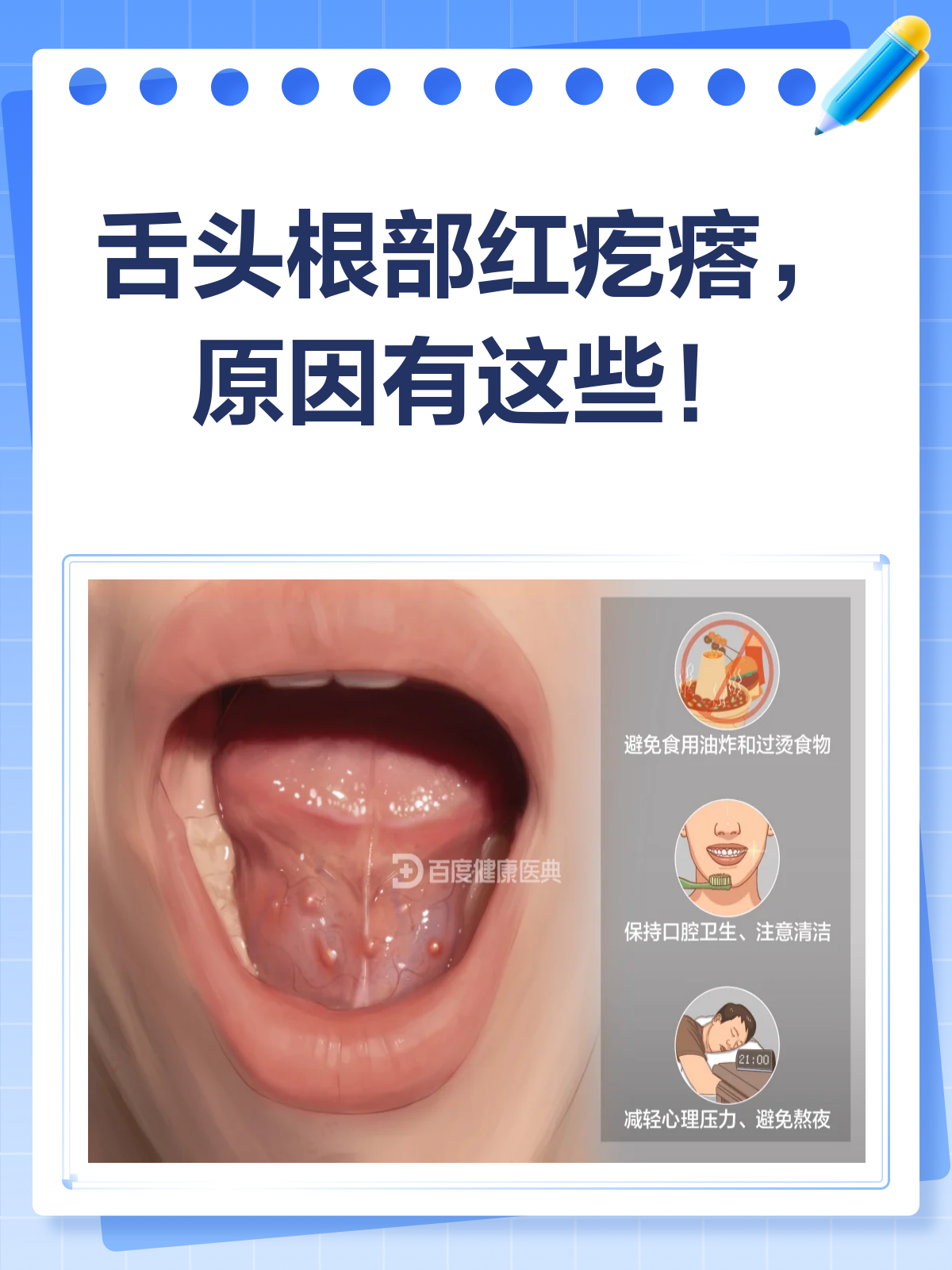 舌头根部红疙瘩凸起?别慌,先看这篇!