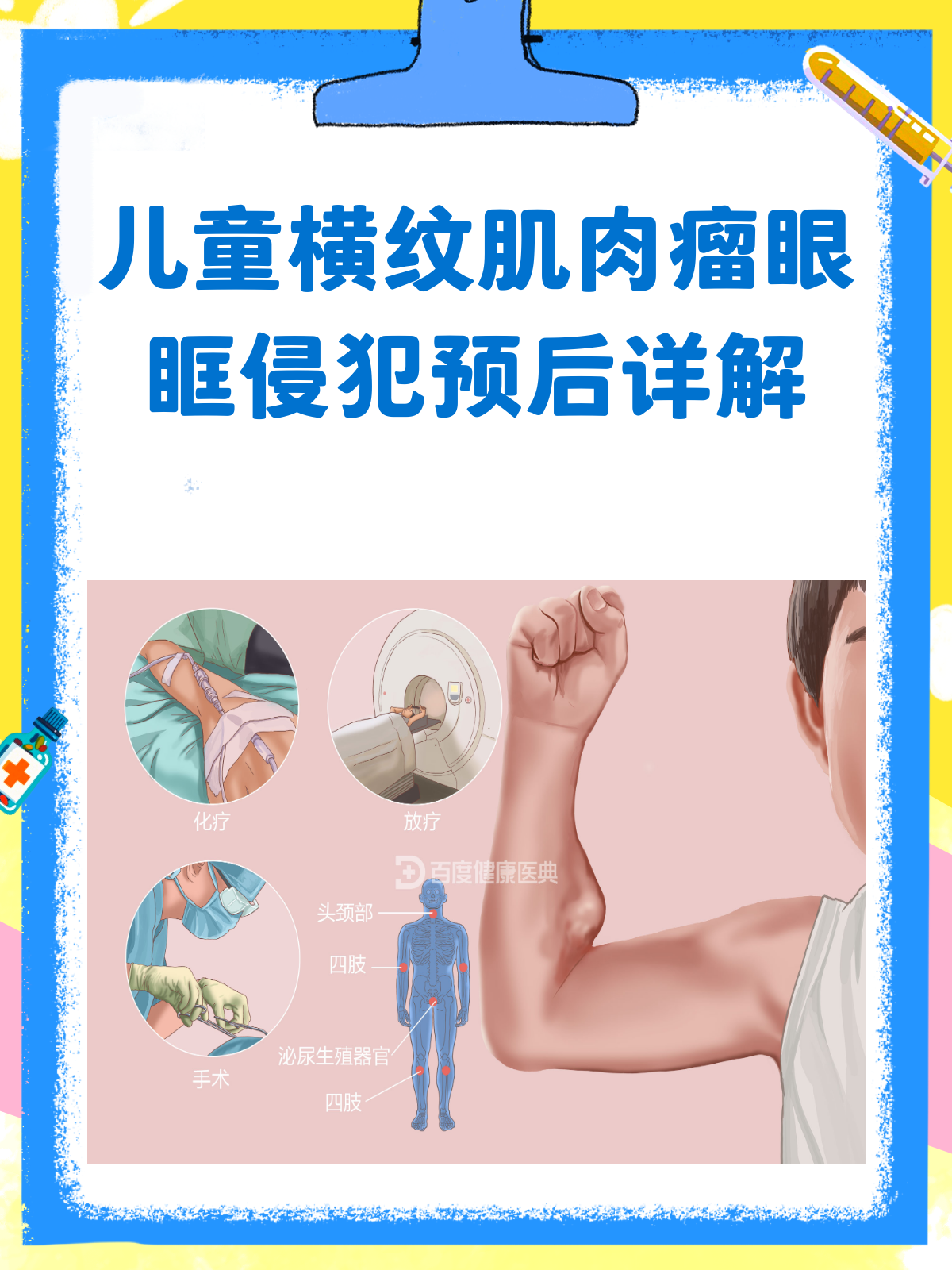 儿童横纹肌肉瘤眼眶侵犯,预后怎么样?