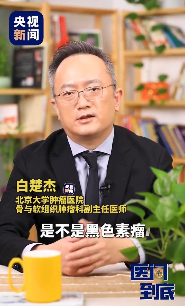 「什么样的痣可能是黑色素瘤?医生教你辨别」黑色素瘤