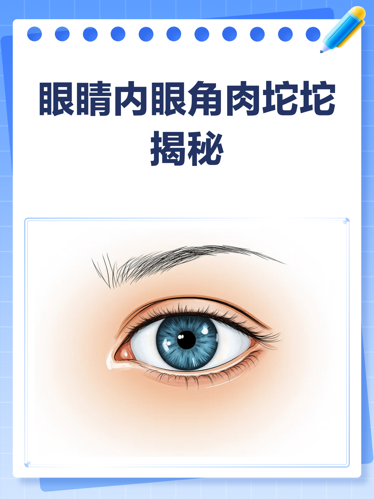 眼睛内眼角肉坨坨?揭秘它的真面目!
