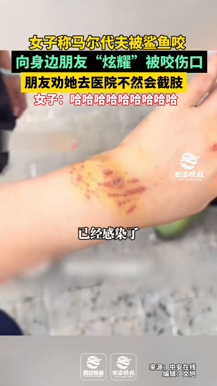 女子称马尔代夫被鲨鱼咬,向身边朋友“炫耀”被咬伤口