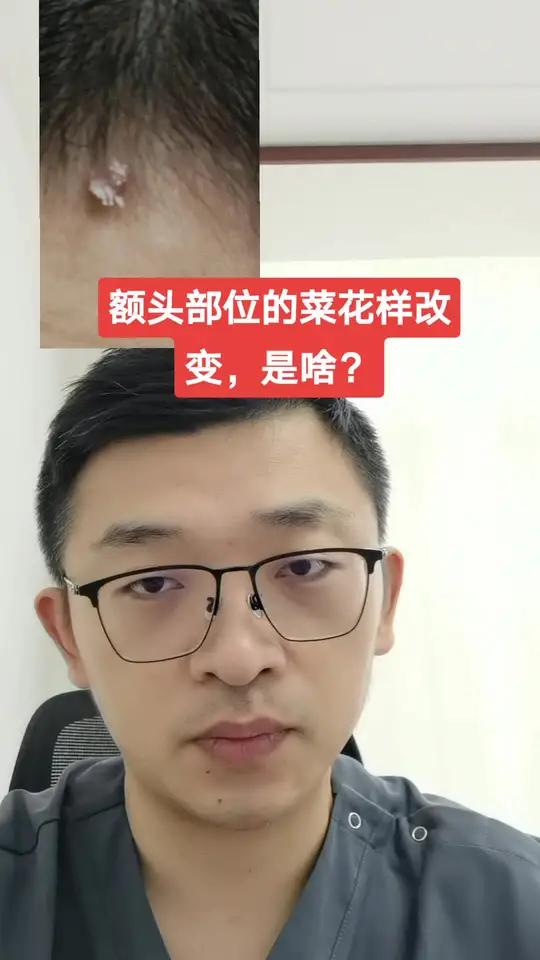 额头部位的菜花样改变,是啥