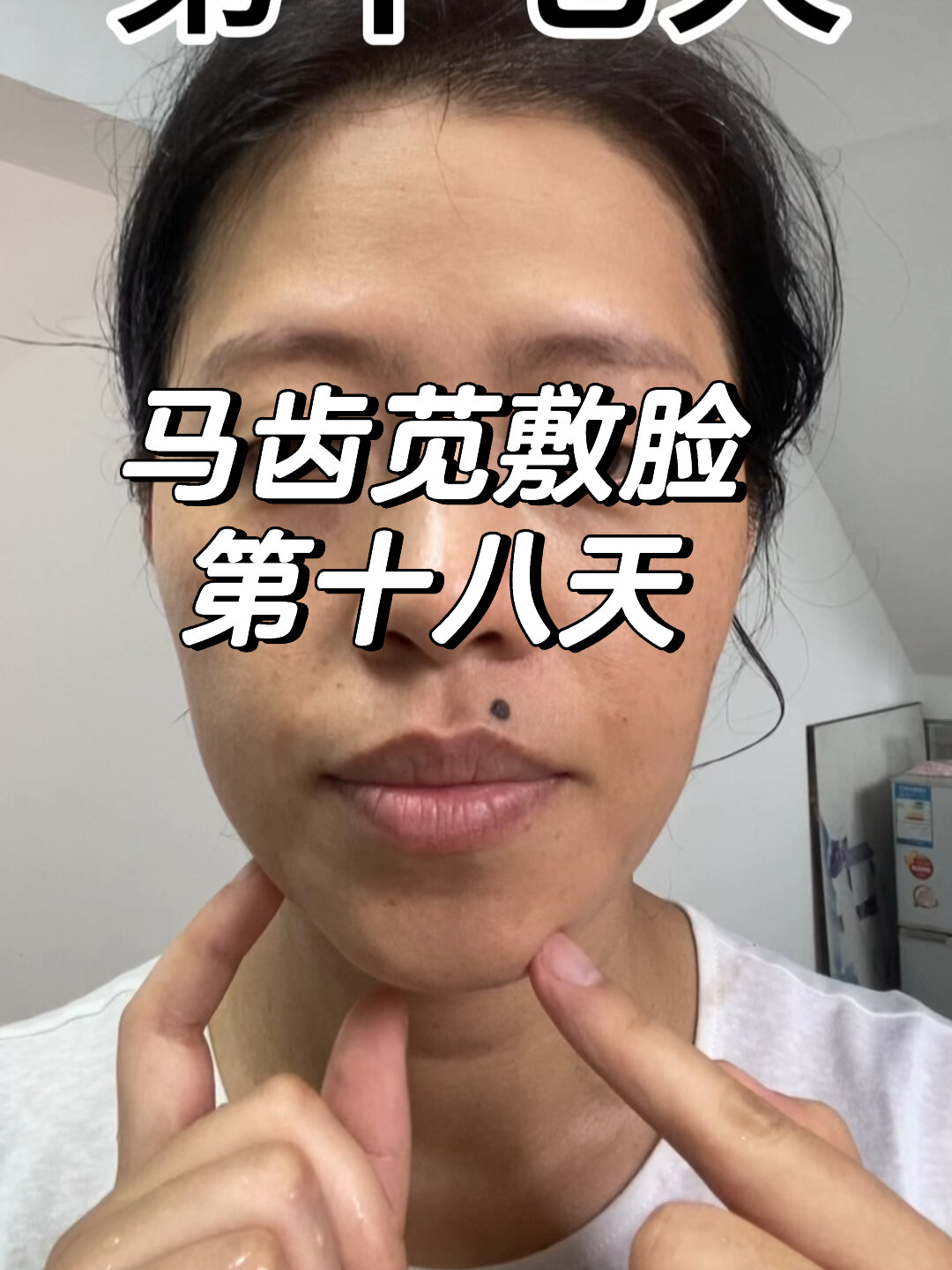 马齿苋可以祛斑吗