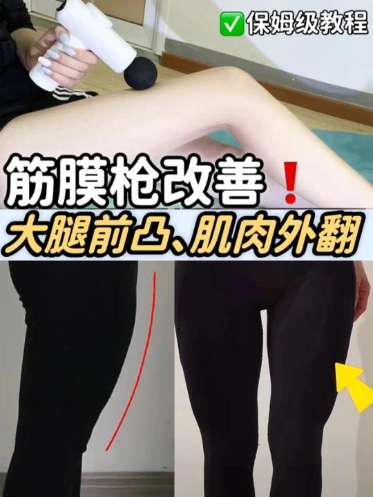 大腿前凸肌肉外翻有救了千万别盲目运动