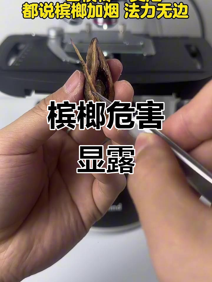 看看槟榔对口腔的危害,显微镜下真相大揭秘