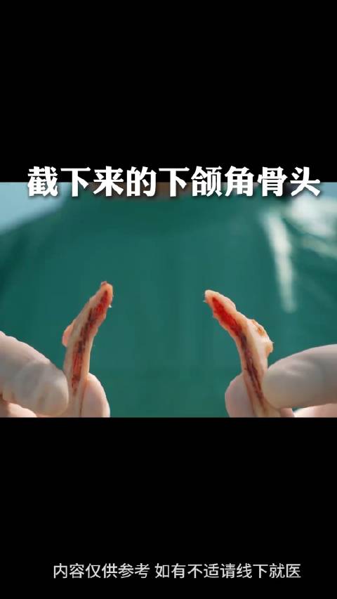 截下来的下颌角有什么?一个视频告诉你,我们截下来的下颌角骨头都含什么物质