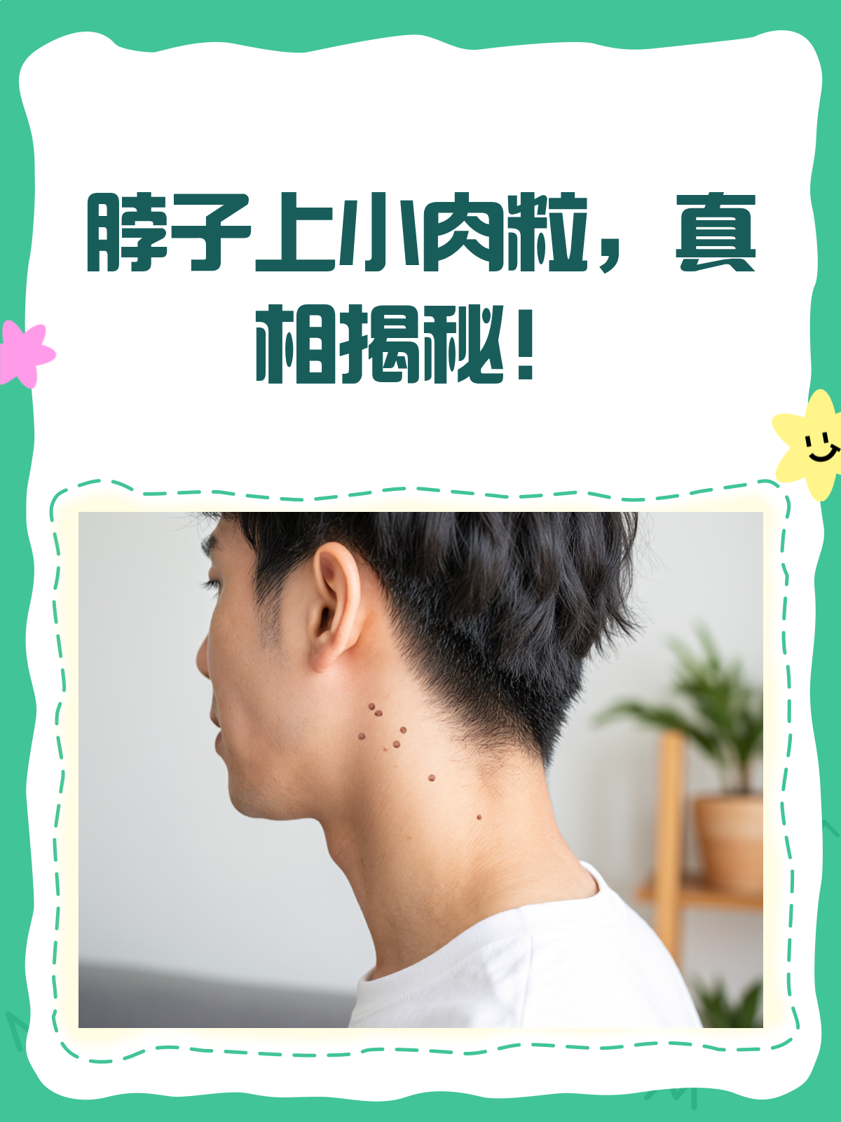 脖子上长小肉粒是皮肤老化还是别的?