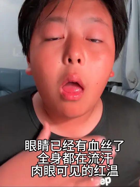 播挑战吃缺牙齿!辣死了啊啊啊!