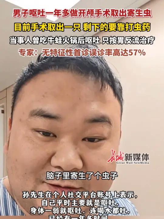 2月18日报道,河南郑州。男子呕吐一年多做开颅手术取出寄生虫目前手术取出一只 剩下的要靠打